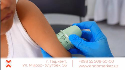 At the outpatient clinic of the Y.X.Turakulov Republic Scientific and Practical Medical Center of Epidemiology and Epidemiology, patients have access to a modern service: the installation of a 24-hour glucose monitoring (CGM) system.