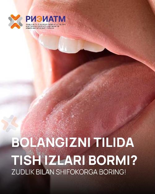 Does your child have teeth prints on their tongue?