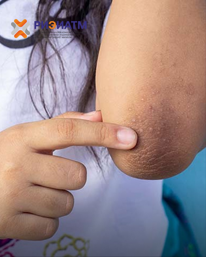 503651731_18045781367545413_2590962820773115980_n.jpg 503651731_18045781367545413_2590962820773115980_n.jpg