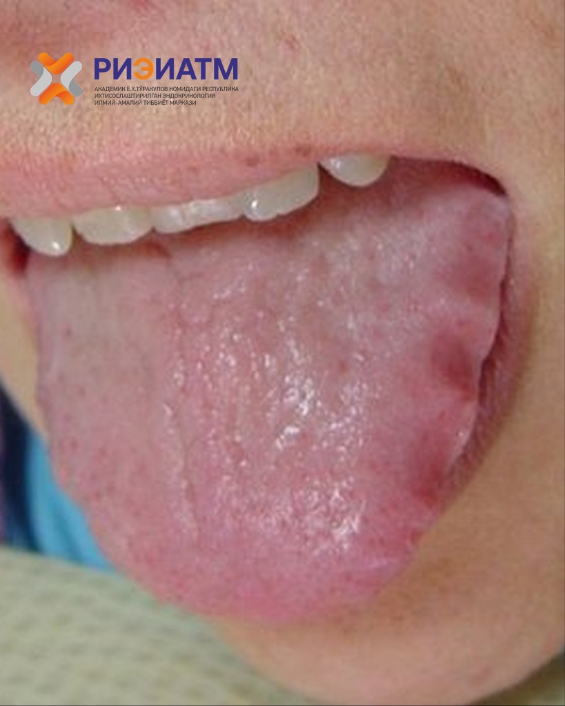 514767603_18047103650545413_1122341030797630221_n.jpg 514767603_18047103650545413_1122341030797630221_n.jpg