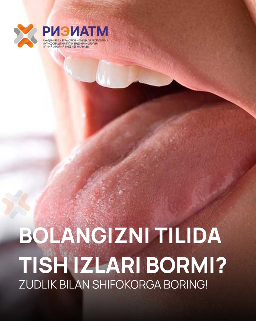 515007148_18047103614545413_4640291122265857762_n.jpg 515007148_18047103614545413_4640291122265857762_n.jpg