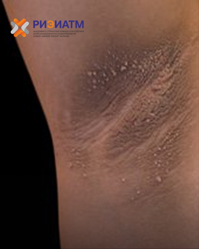 509261517_18045781343545413_6035224243726017814_n.jpg 509261517_18045781343545413_6035224243726017814_n.jpg