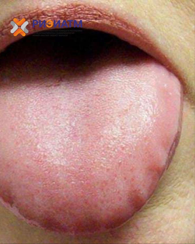 516050491_18047103668545413_6910323978982292503_n.jpg 516050491_18047103668545413_6910323978982292503_n.jpg